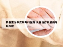 长春主治牛皮癣专科医院 长春治疗银屑病专科医院