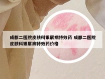成都二医院皮肤科银屑病特效药 成都二医院皮肤科银屑病特效药价格