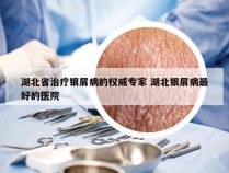 湖北省治疗银屑病的权威专家 湖北银屑病最好的医院