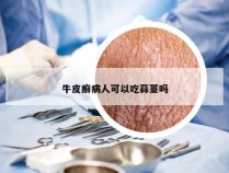 牛皮癣病人可以吃蒜薹吗