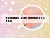 银屑病可以吃21金维吗 银屑病能吃复合维生素吗