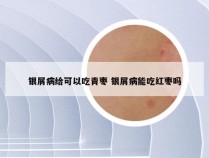 银屑病给可以吃青枣 银屑病能吃红枣吗