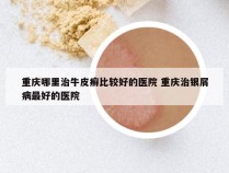 重庆哪里治牛皮癣比较好的医院 重庆治银屑病最好的医院