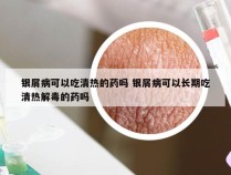 银屑病可以吃清热的药吗 银屑病可以长期吃清热解毒的药吗