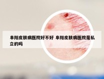 阜阳皮肤病医院好不好 阜阳皮肤病医院是私立的吗