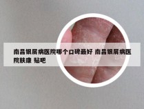 南昌银屑病医院哪个口碑最好 南昌银屑病医院肤康 贴吧
