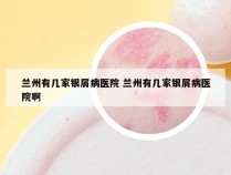 兰州有几家银屑病医院 兰州有几家银屑病医院啊