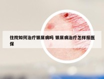 住院如何治疗银屑病吗 银屑病治疗怎样报医保