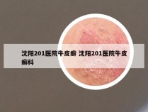 沈阳201医院牛皮癣 沈阳201医院牛皮癣科