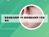 银屑病能吃腌萝卜吗 银屑病能吃腌萝卜吗有毒吗
