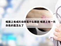 嘴唇上有成片白斑是什么原因 嘴唇上有一片白色的是怎么了
