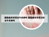 醋酸曲安奈德治牛皮癣吗 醋酸曲安奈德注射治牛皮癣吗
