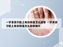 一岁多孩子脸上有白斑是怎么回事 一岁多孩子脸上有白斑是怎么回事图片