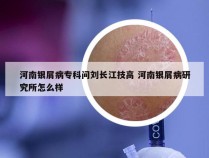 河南银屑病专科问刘长江技高 河南银屑病研究所怎么样