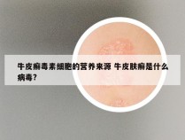 牛皮癣毒素细胞的营养来源 牛皮肤癣是什么病毒?