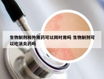 生物制剂和外用药可以同时用吗 生物制剂可以吃消炎药吗