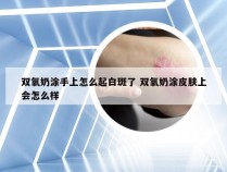 双氧奶涂手上怎么起白斑了 双氧奶涂皮肤上会怎么样