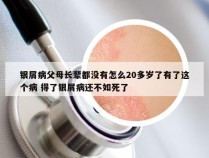银屑病父母长辈都没有怎么20多岁了有了这个病 得了银屑病还不如死了