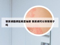 银屑病胳膊能戴套袖那 银屑病可以带银镯子吗