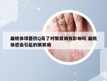 扁桃体球菌抗Q高了对银屑病有影响吗 扁桃体感染引起的银屑病