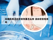 白癜风用消白软膏效果怎么样 消白软膏有用吗