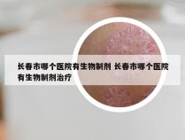 长春市哪个医院有生物制剂 长春市哪个医院有生物制剂治疗