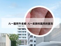 八一医院牛皮癣 八一皮肤科医院的医生