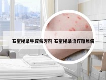 石室秘录牛皮癣方剂 石室秘录治疗糖尿病