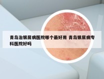 青岛治银屑病医院哪个最好用 青岛银屑病专科医院好吗