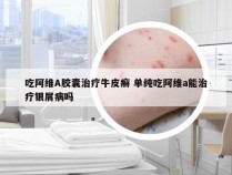 吃阿维A胶囊治疗牛皮癣 单纯吃阿维a能治疗银屑病吗