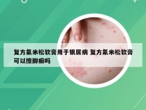 复方氟米松软膏用于银屑病 复方氟米松软膏可以擦脚癣吗