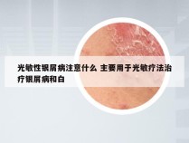 光敏性银屑病注意什么 主要用于光敏疗法治疗银屑病和白