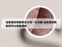 皮肤病生物制剂多少钱一针法国 皮肤病生物制剂可以报医保吗