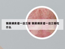 银屑病食谱一日三餐 银屑病食谱一日三餐吃什么