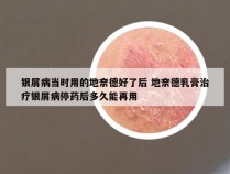 银屑病当时用的地奈德好了后 地奈德乳膏治疗银屑病停药后多久能再用
