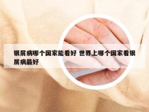 银屑病哪个国家能看好 世界上哪个国家看银屑病最好