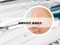 顽癣特效药 顽癣秘方