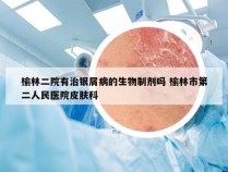 榆林二院有治银屑病的生物制剂吗 榆林市第二人民医院皮肤科