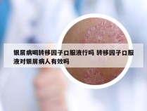 银屑病喝转移因子口服液行吗 转移因子口服液对银屑病人有效吗