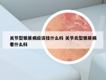 关节型银屑病应该挂什么科 关节炎型银屑病看什么科