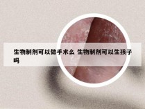 生物制剂可以做手术么 生物制剂可以生孩子吗