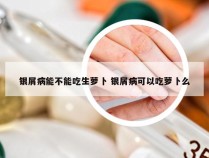 银屑病能不能吃生萝卜 银屑病可以吃萝卜么