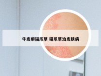 牛皮癣猫爪草 猫爪草治皮肤病