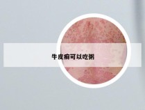 牛皮癣可以吃粥