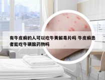 有牛皮癣的人可以吃牛黄解毒片吗 牛皮癣患者能吃牛磺酸药物吗