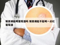 银屑病能喝葡萄酒吗 银屑病能不能喝一点红葡萄酒