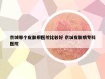 京城哪个皮肤癣医院比较好 京城皮肤病专科医院