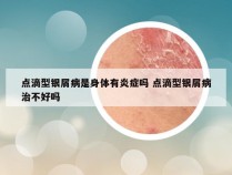 点滴型银屑病是身体有炎症吗 点滴型银屑病治不好吗