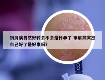 银屑病自然好转会不会是怀孕了 银屑病突然自己好了是好事吗?