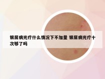 银屑病光疗什么情况下不加量 银屑病光疗十次够了吗